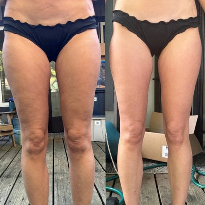 SilkSkin™ - Skin Toning Massager